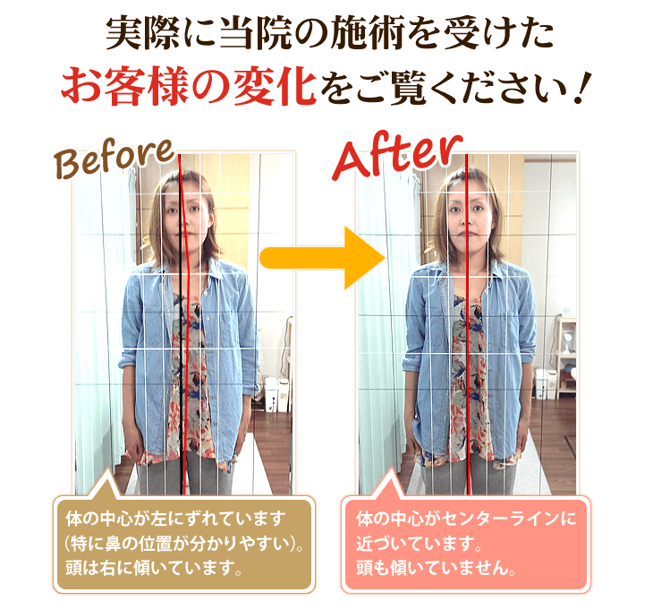 実際に高松市の当整体院で骨盤矯正施術を受けたお客様の変化